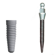 Photo of affordable dental implants, mini implants for Pasadena dentist Dr. Arash Azarbal.